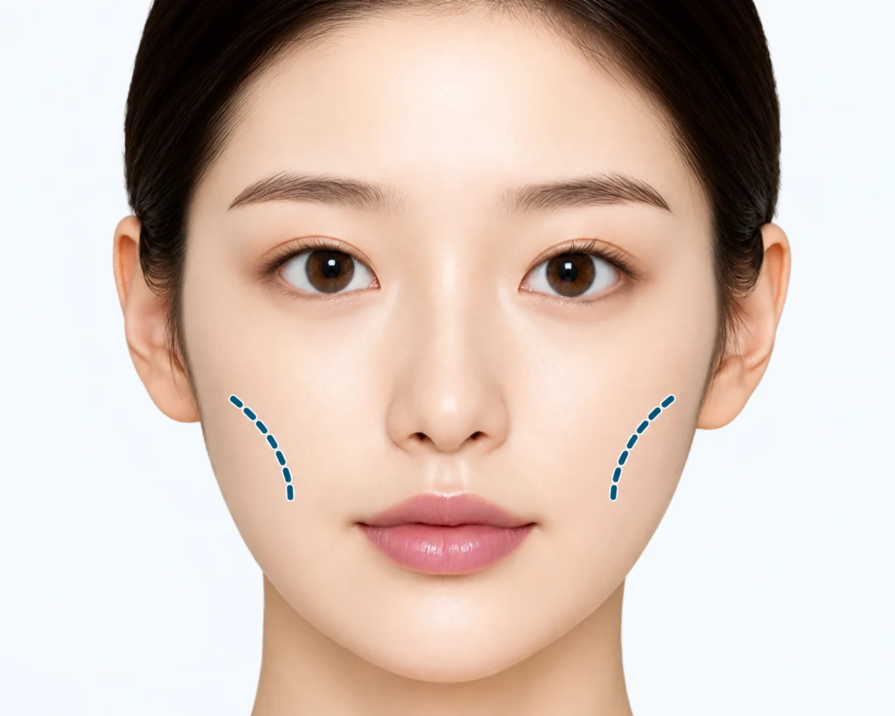 頬のくぼみで老けて見える場合 — 頬骨が目立ち、疲れて見える場合