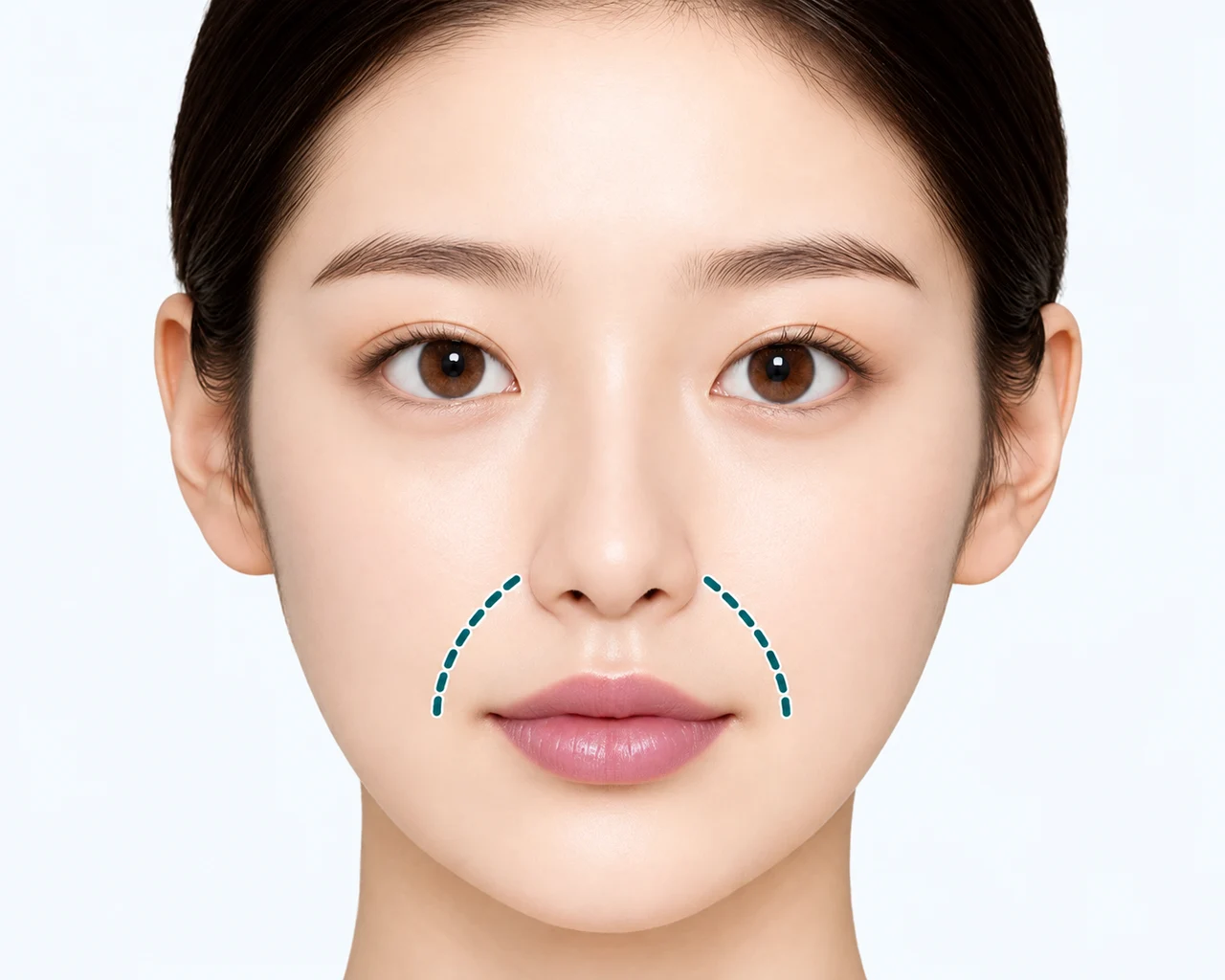 ほうれい線が深く見える場合 — ほうれい線の深まりで実年齢より老けて見える場合