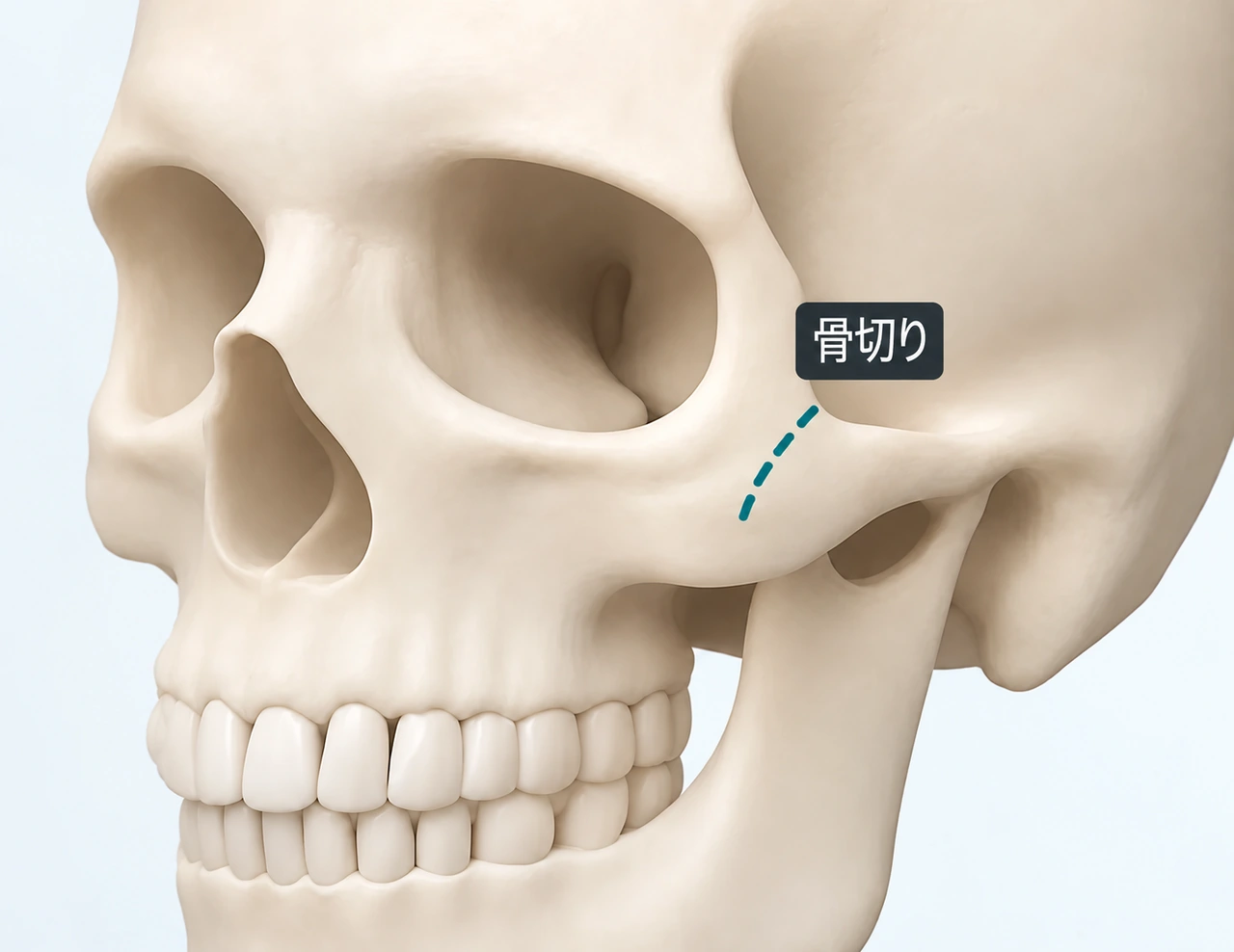 側方の頬骨の構造